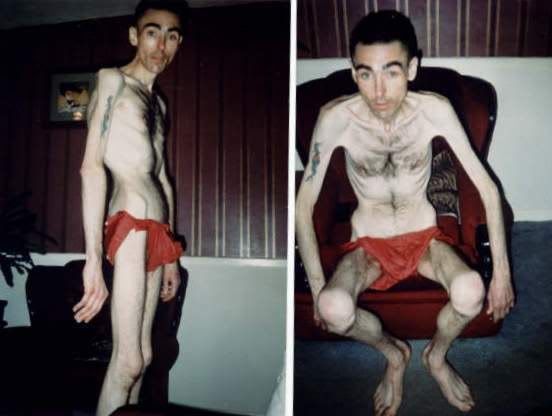 skinnyman.jpg